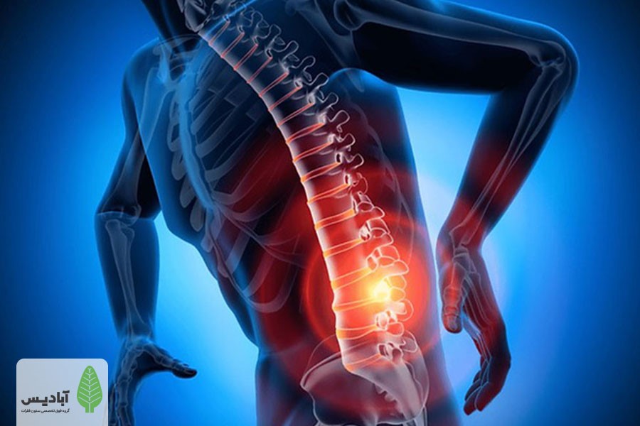 یکی از ساده‌ترین و کاربردی‌ترین راه‎‌های درمان دیسک کمر، استفاده از کمربند طبی است.