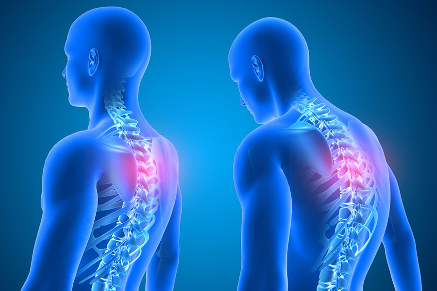 دکتر جراح اسکولیوز